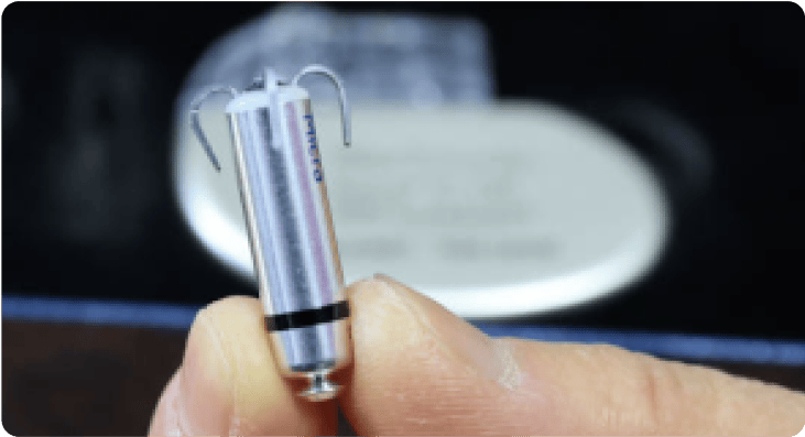 Leadless Pacemaker - Minimally Invasive Heart Device